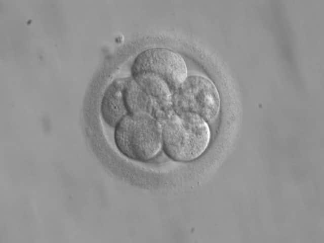 embryo transfer